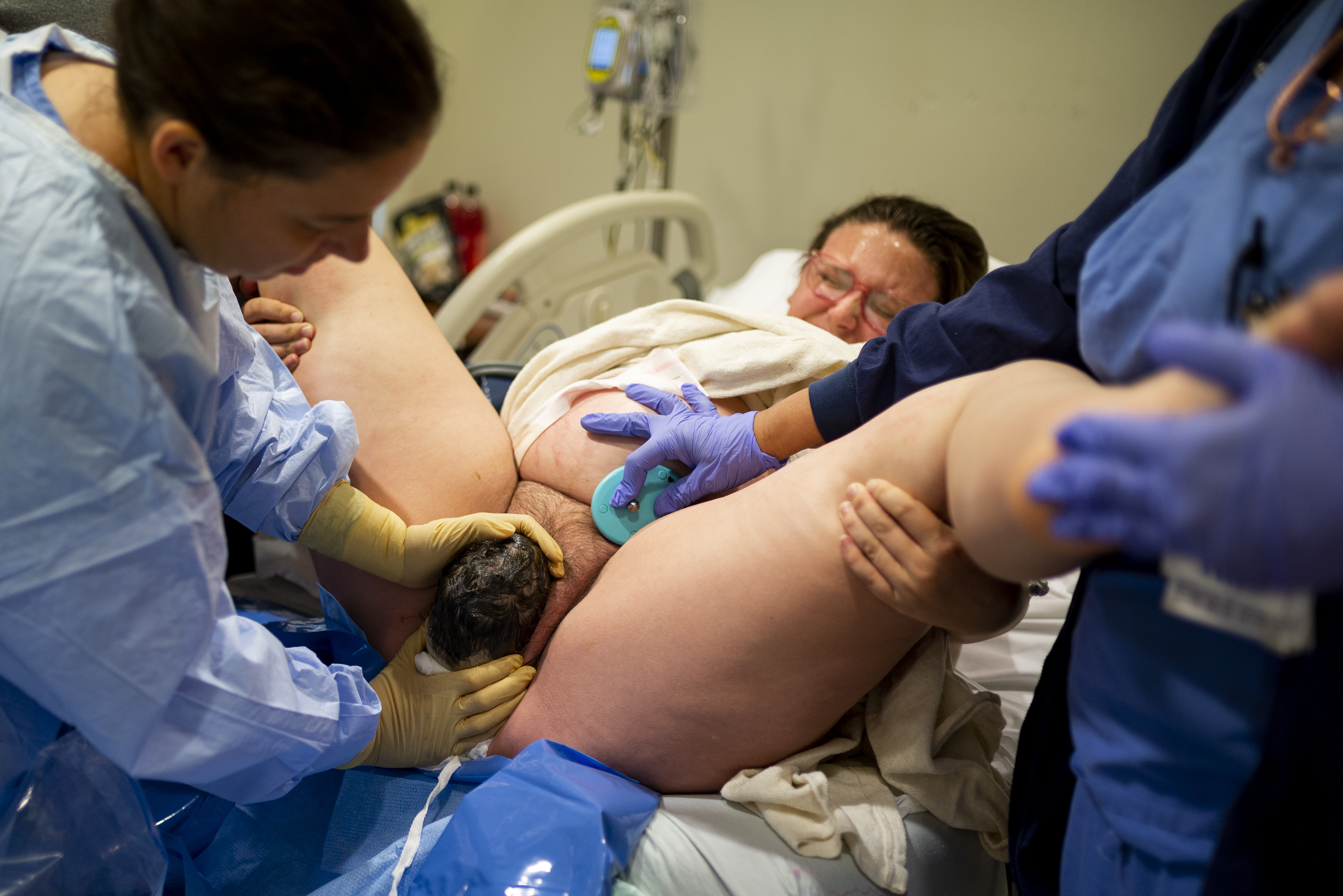 Baby Crowning at hospital birth in Annapolis, MD